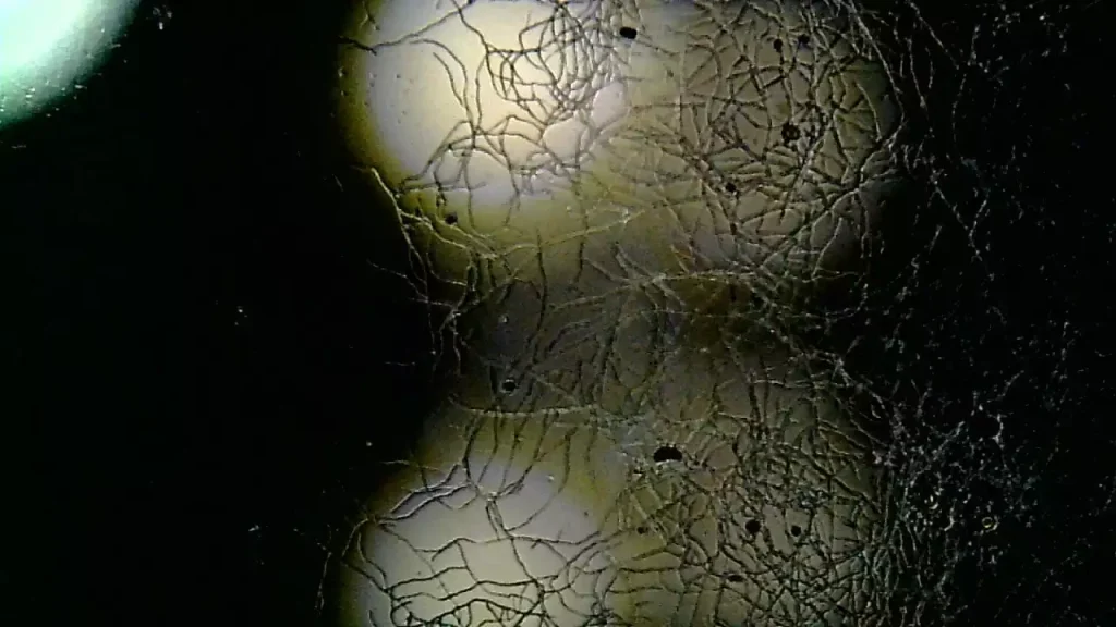 branching fungal hyphae
